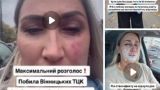 Жительницы Винницы отвоевала мужика у ТЦК — видео