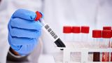 Тесты на антитела к коронавирусу в России могут начать делать уже в мае